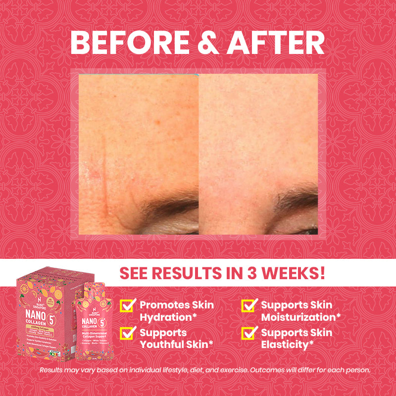 Nano Collagen 5+ Drink - 30ml / 15 Sachets