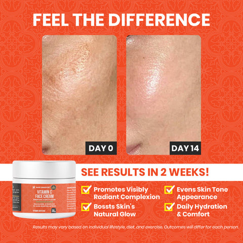 [1-FOR-1 DEALS] Vitamin C Face Cream - 30g