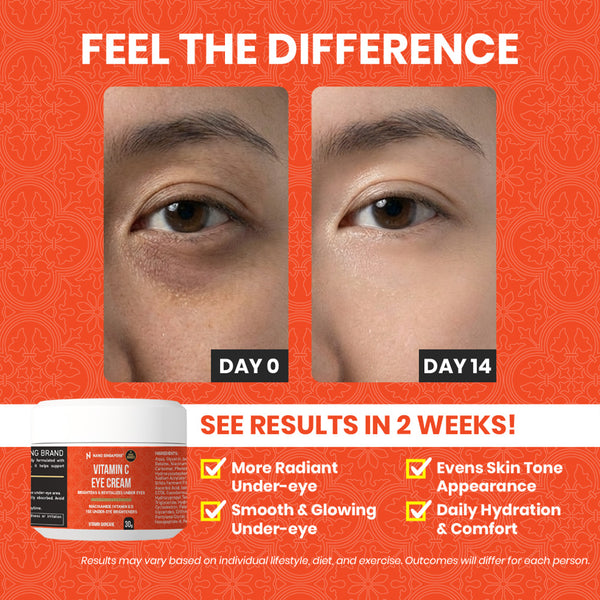 [1-FOR-1 DEALS] Vitamin C Eye Cream - 30g