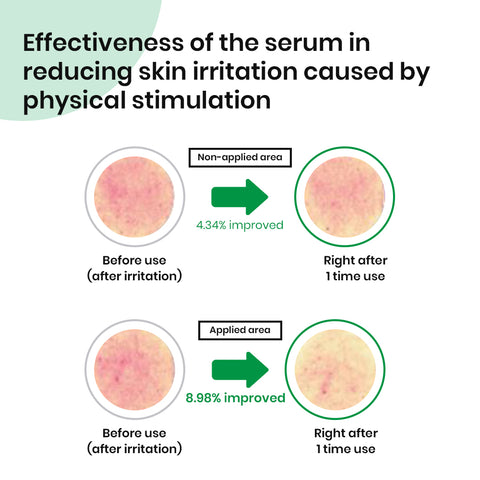 Nano Skinz Tea Tree Oil Serum - 30ml